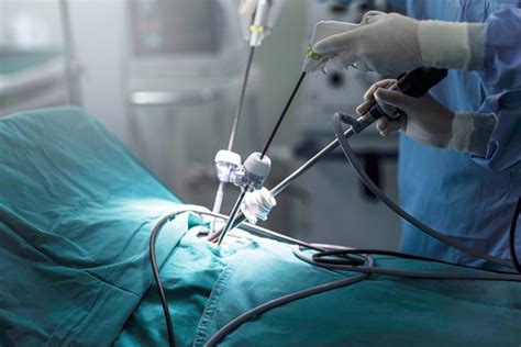 Unraveling the Mystery Behind Laparoscopic Tubal Surgery